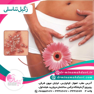زگیل تناسلی  چیست ؟