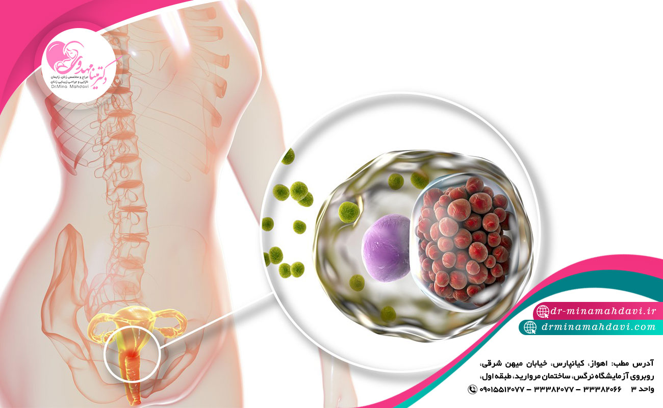 علائم زگیل تناسلی چیست؟