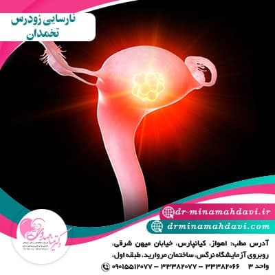 نارسایی زودرس تخمدان