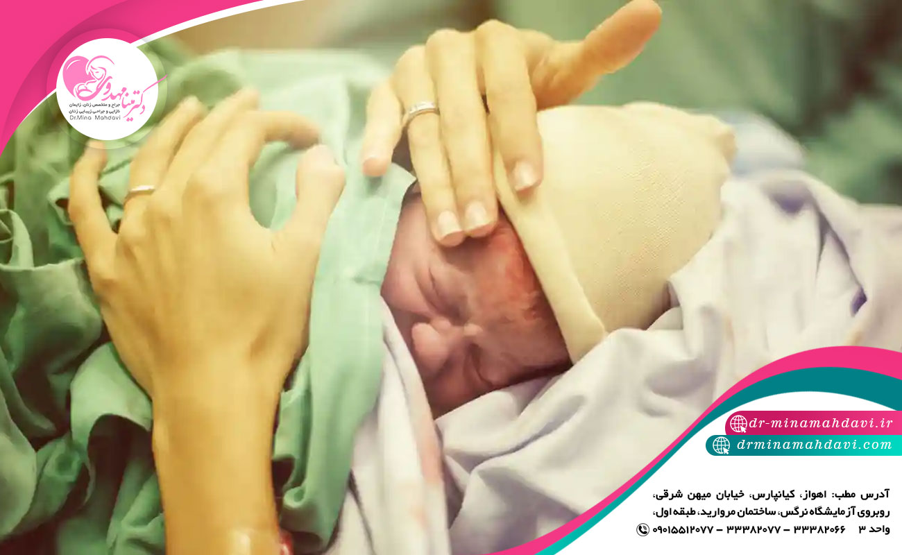 زایمان سزارین
