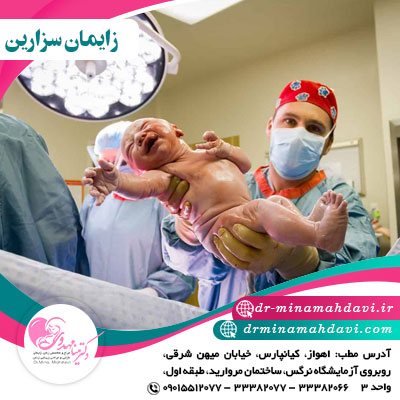 عمل سزارین
