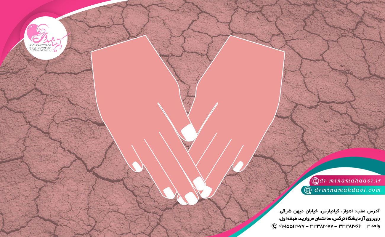 رفع خشکی واژن در دوران یائسگی