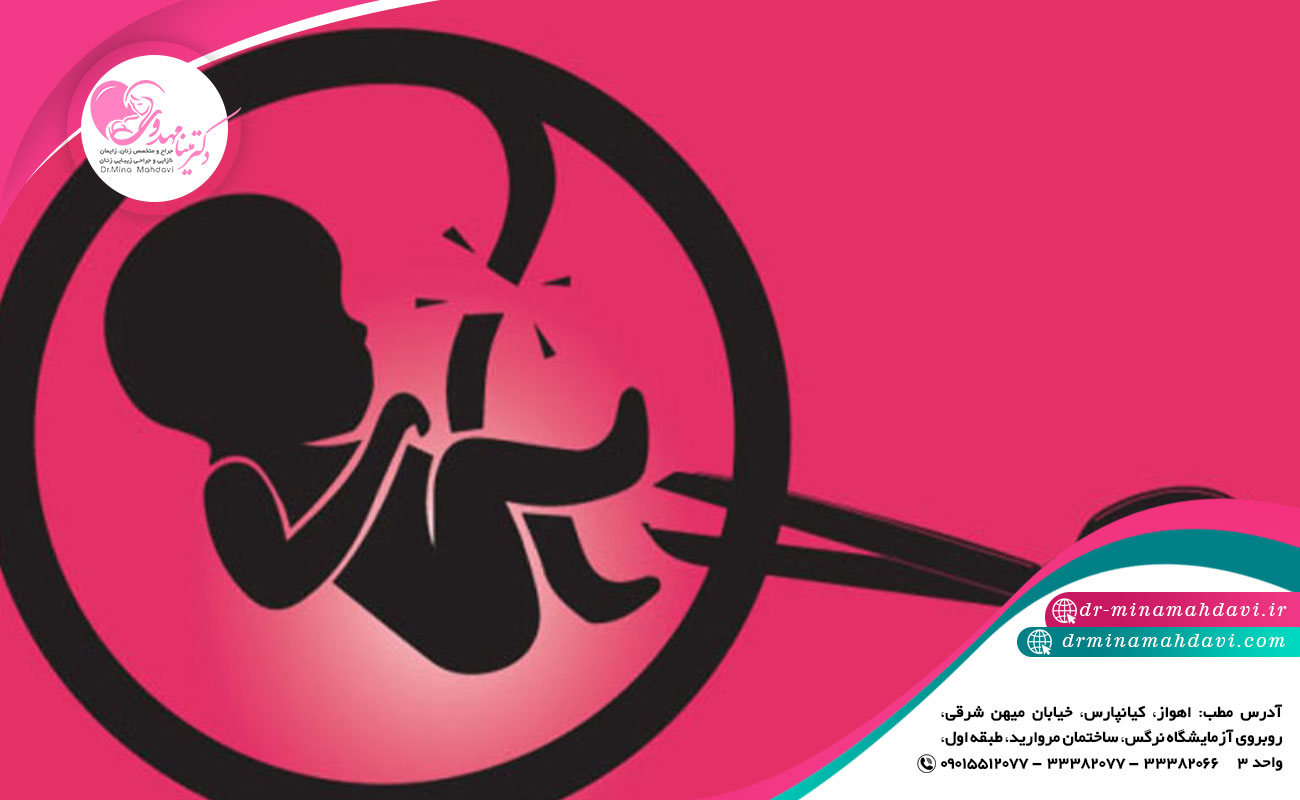 عوارض سقط جنین