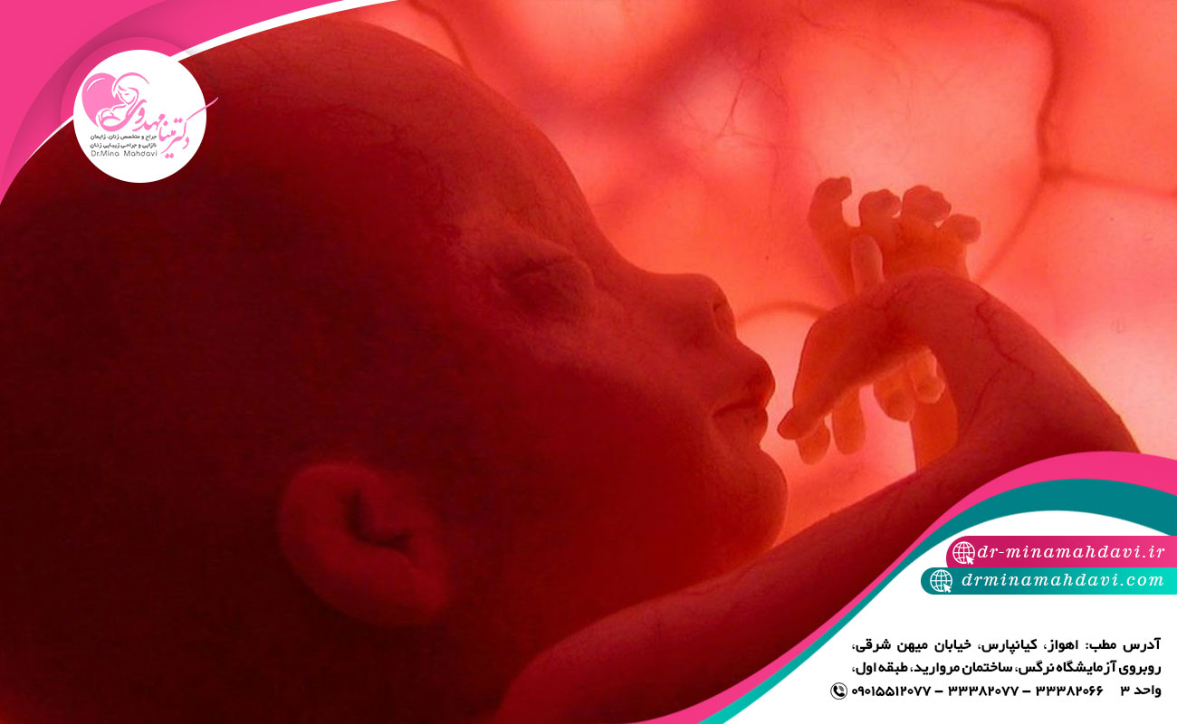 علائم سقط جنین