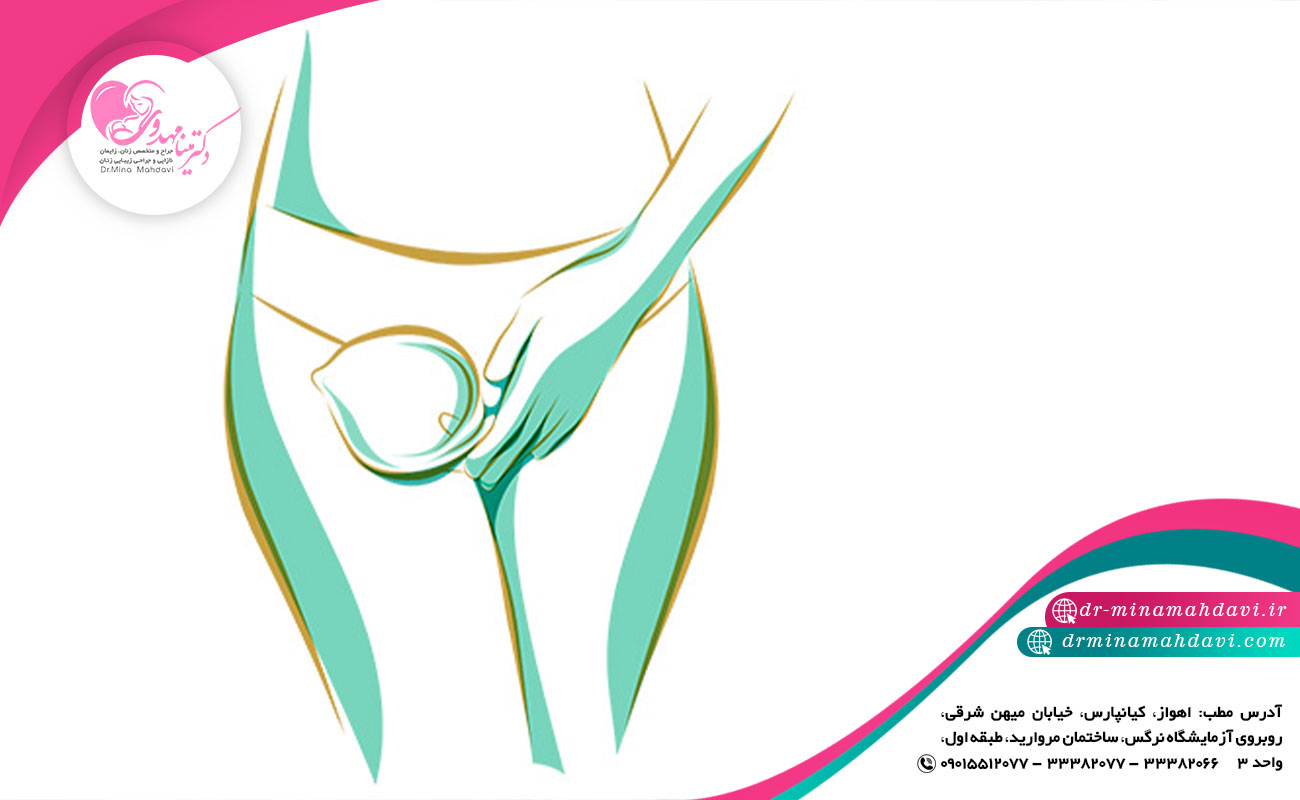  مراقبت های قبل از لابیاپلاستی
