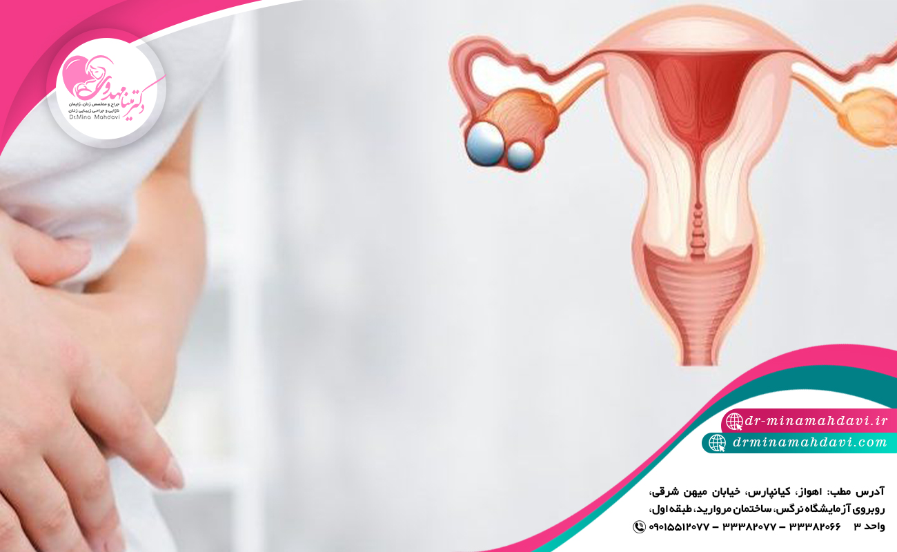 پیشگیری و درمان نارسایی زودرس تخمدان