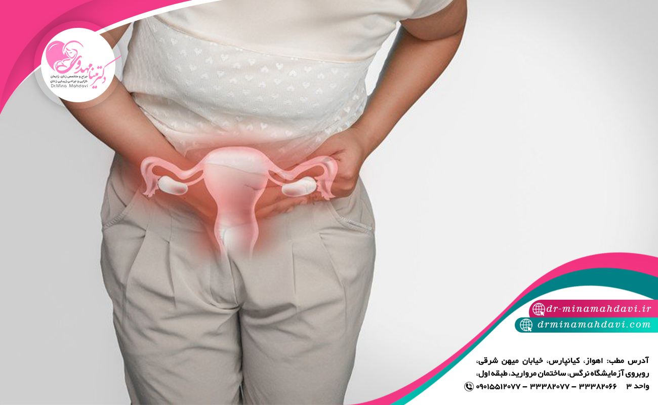 افتادگی رحم بعد از زایمان