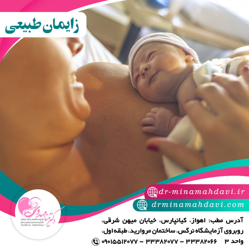 زایمان طبیعی