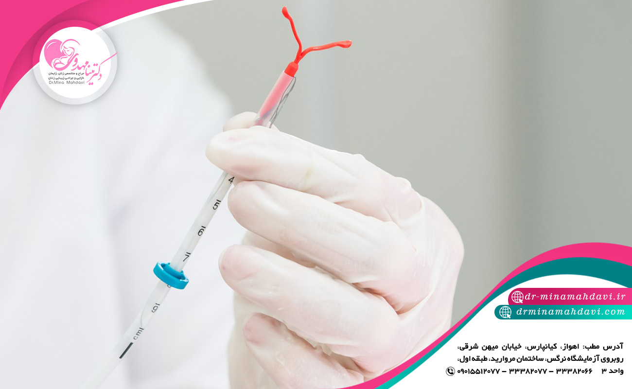 مراقبت بعد از کارگزاری آی یو دی
