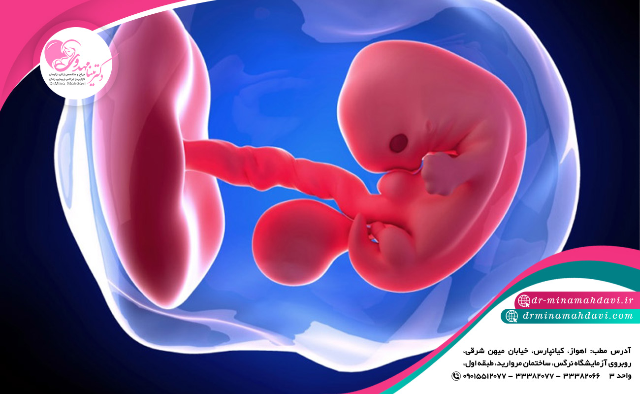 نکات کلیدی در مورد بارداری خارج از رحم