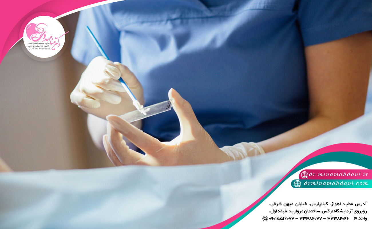آمادگی لازم جهت انجام تست اسمیر