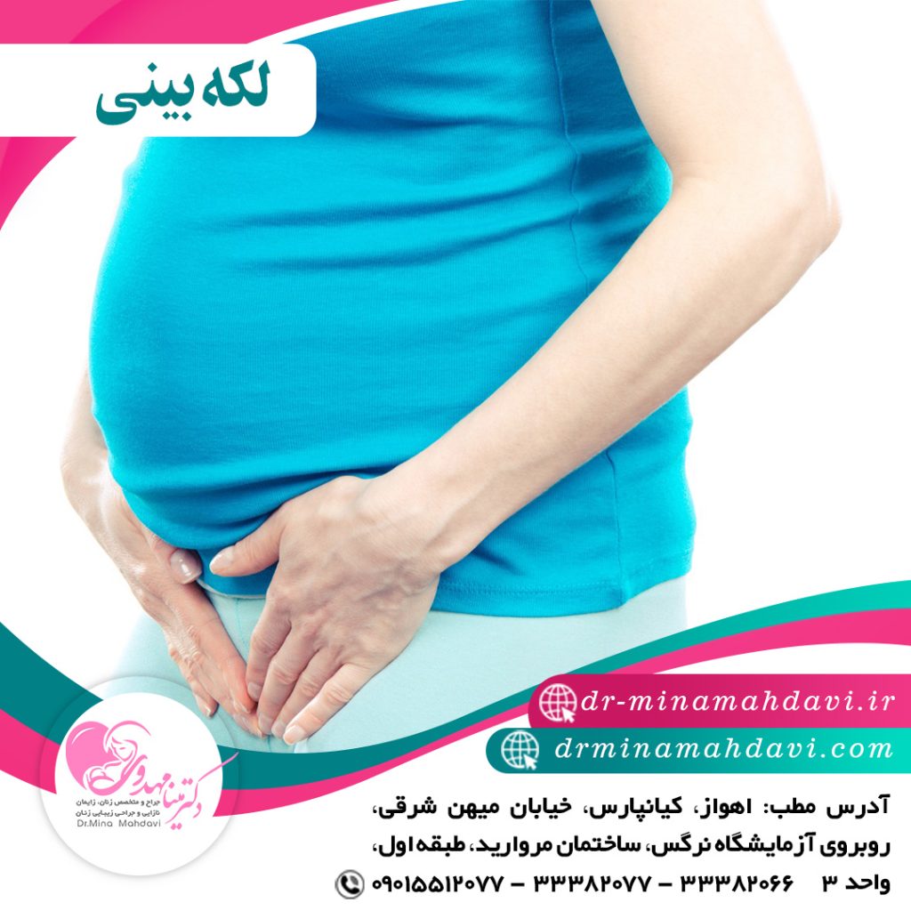 لکه بینی در بارداری