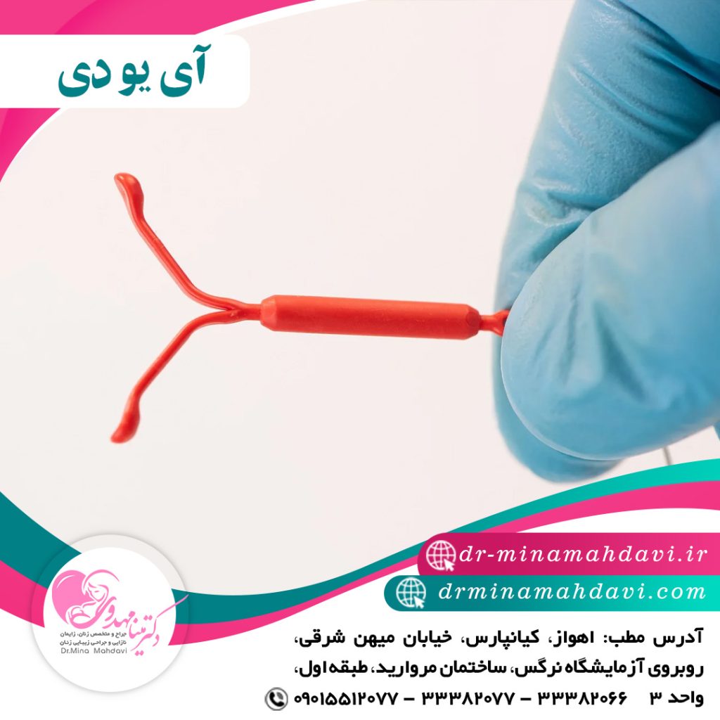 آی یو دی