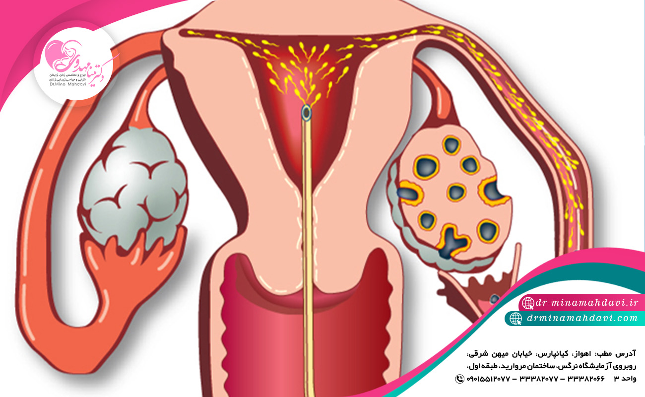 آیا همه ی افراد نازا می توانند از این روش استفاده کنند؟