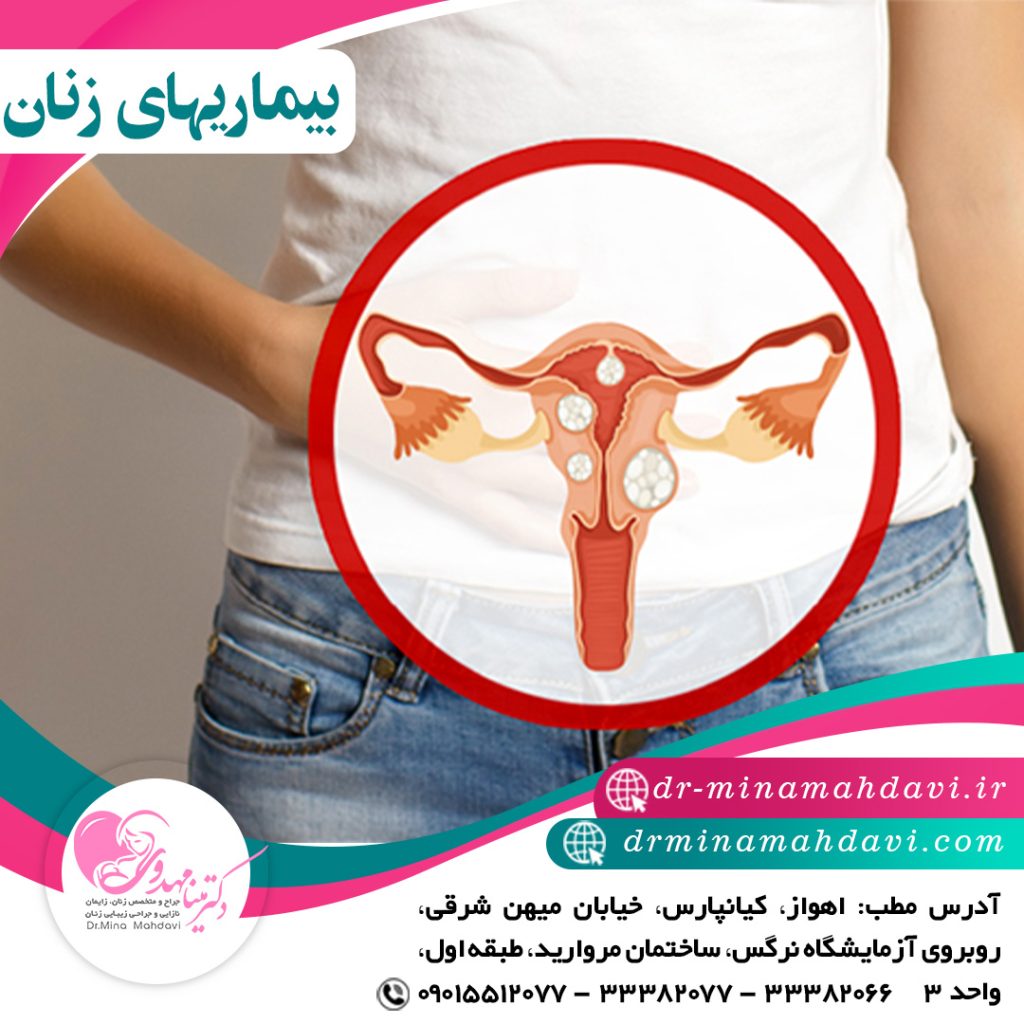 بیماری‌ های زنان