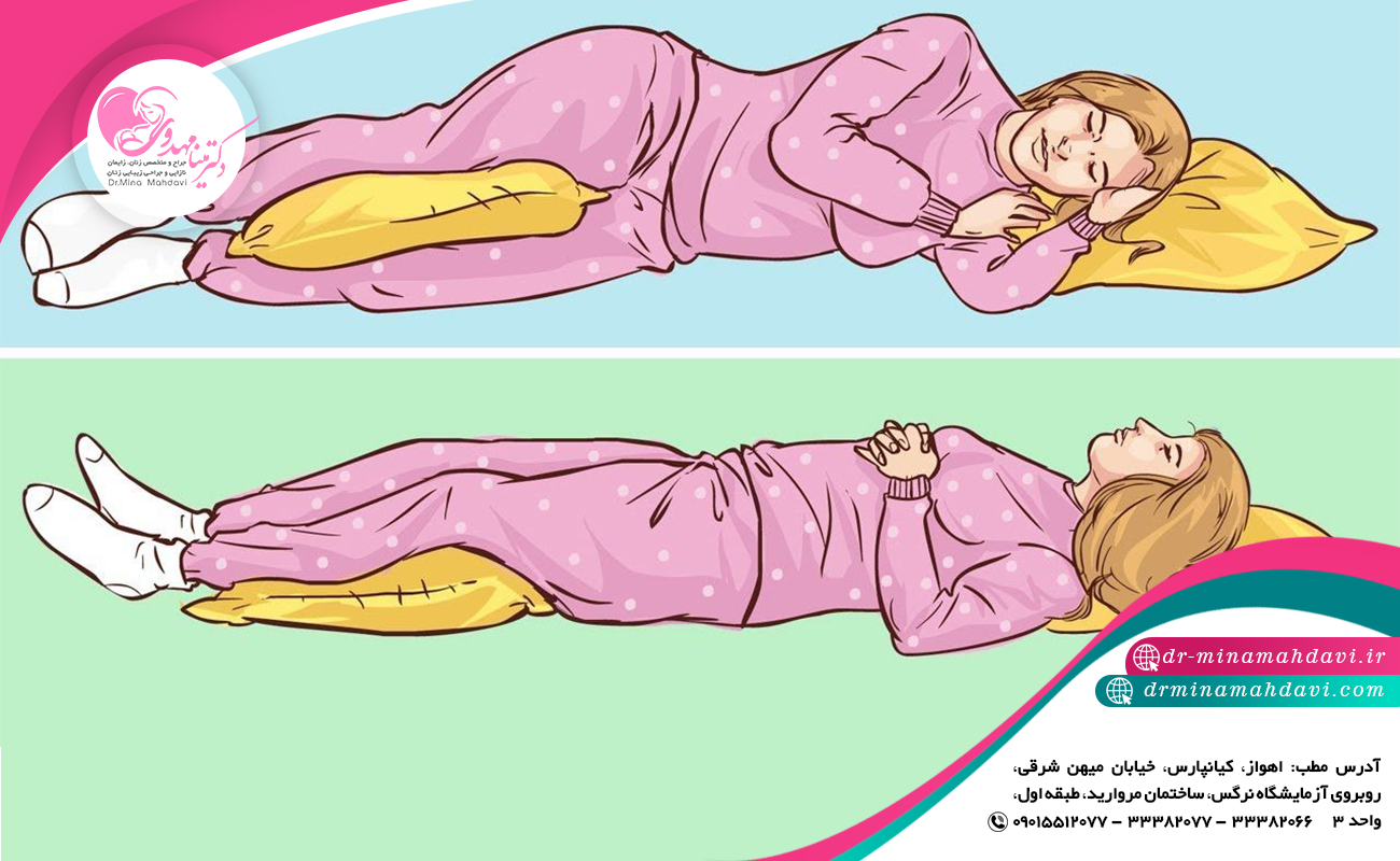 درست خوابیدن چه تاثیری بر نتیجه لابیاپلاستی دارد؟