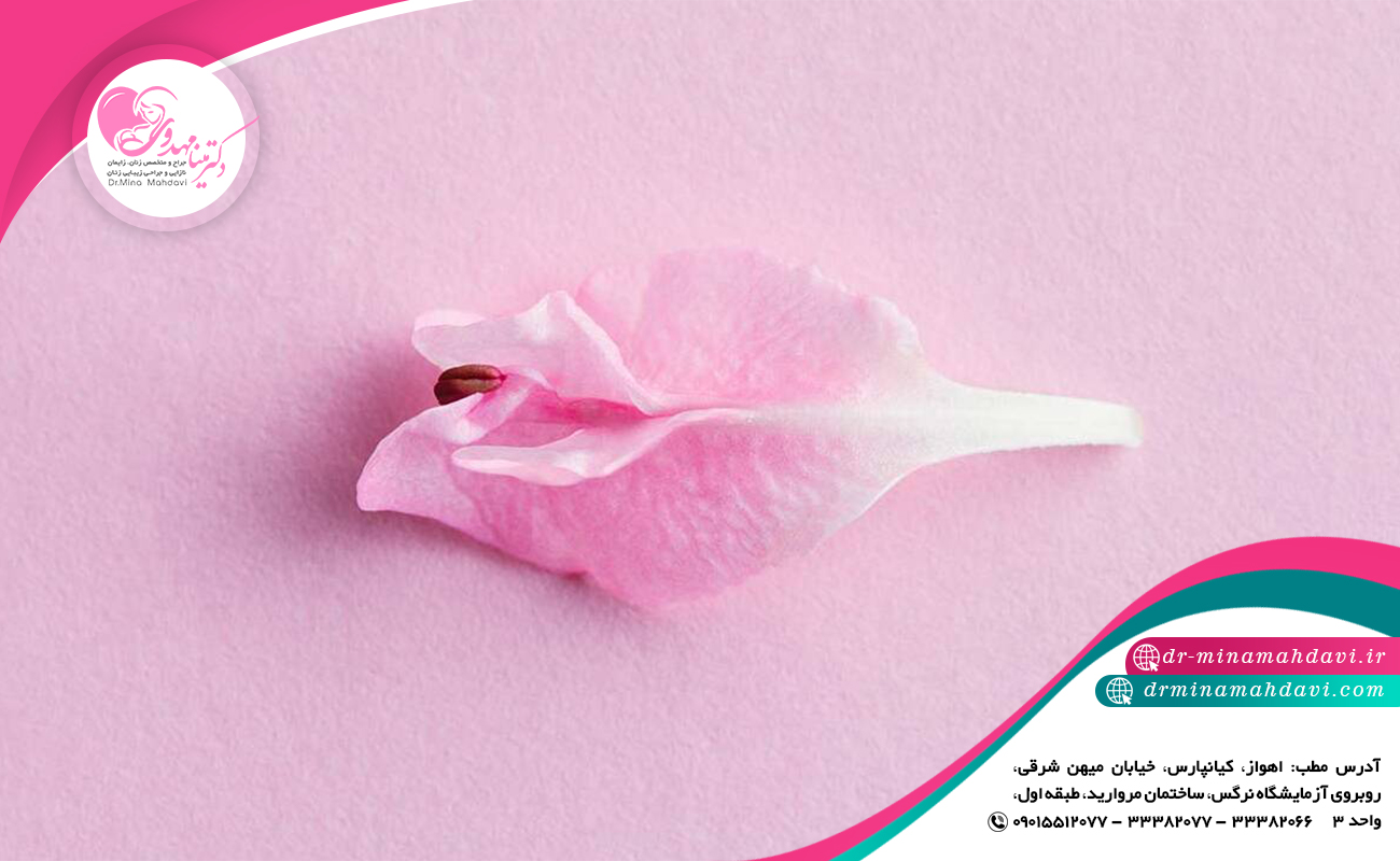 نکاتی در مورد لابیاپلاستی
