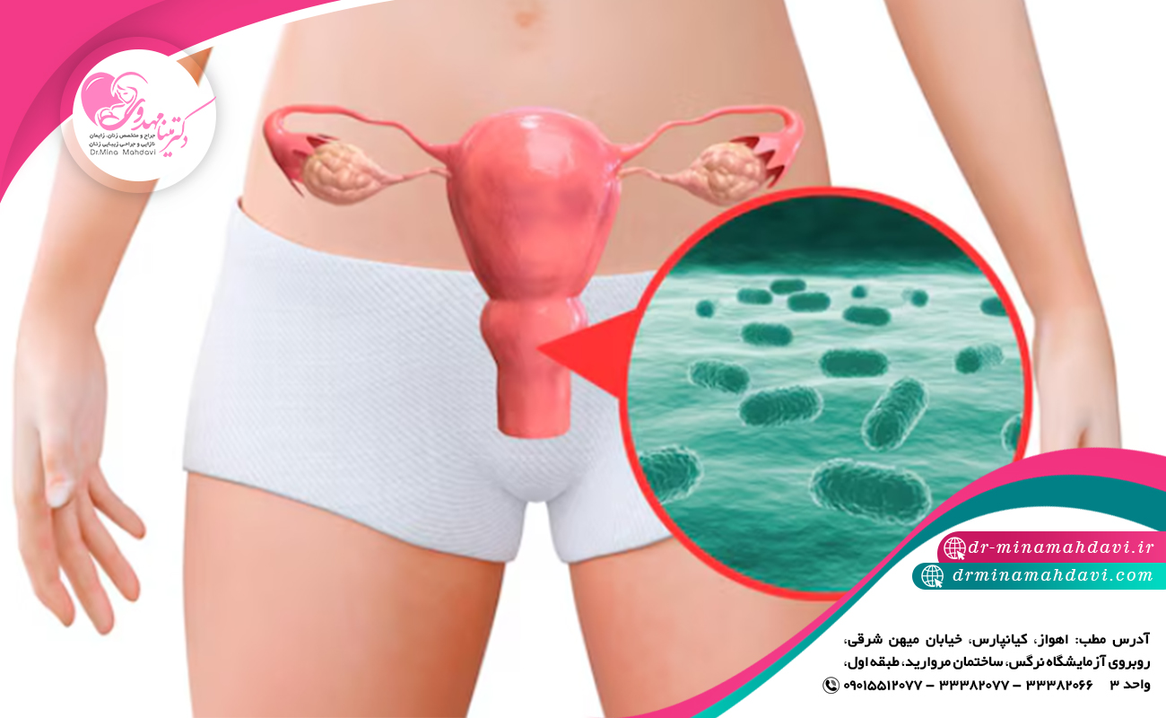 برای درمان عفونت واژن چه باید کرد؟