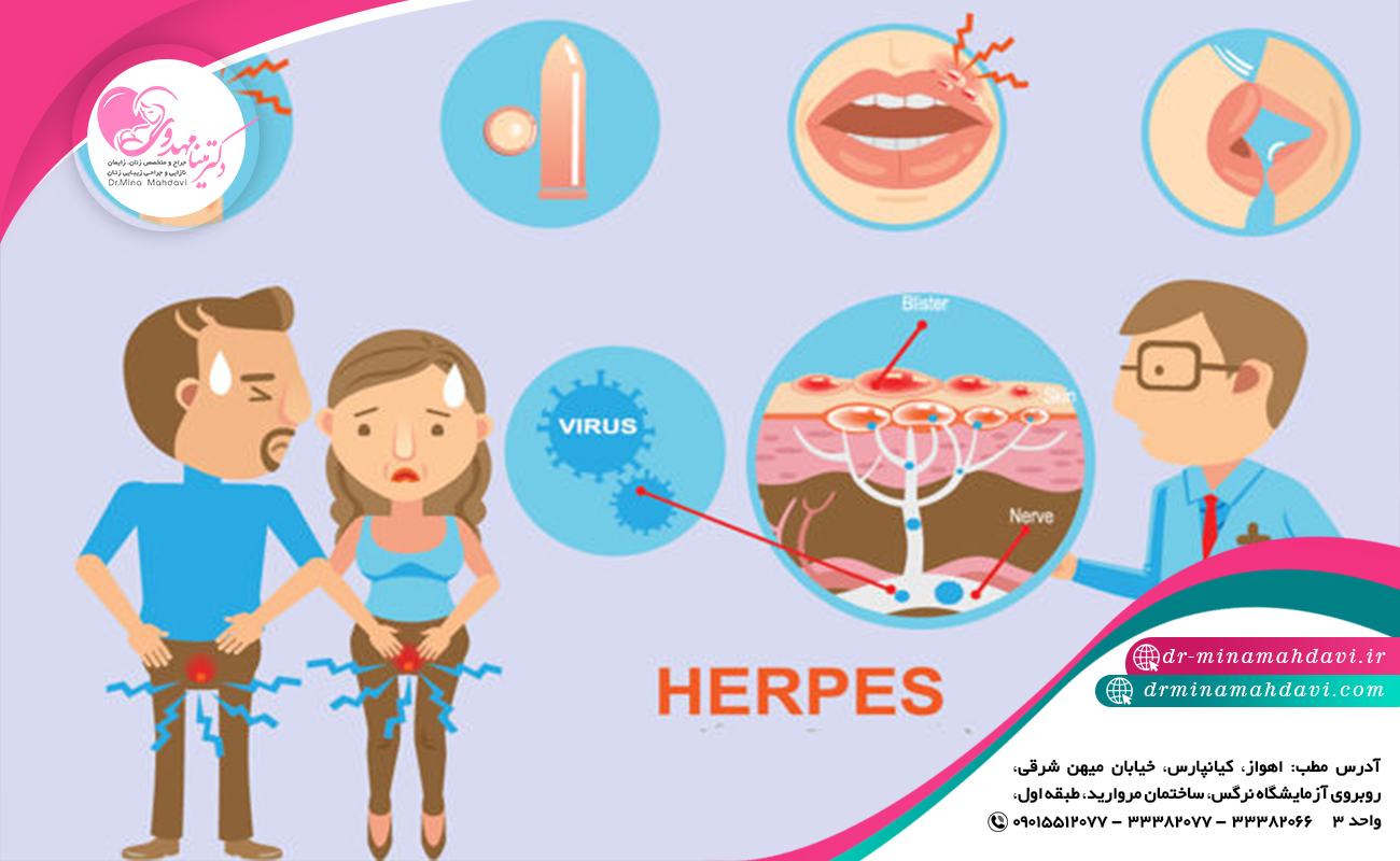 مهمترین عوارض تبخال تناسلی