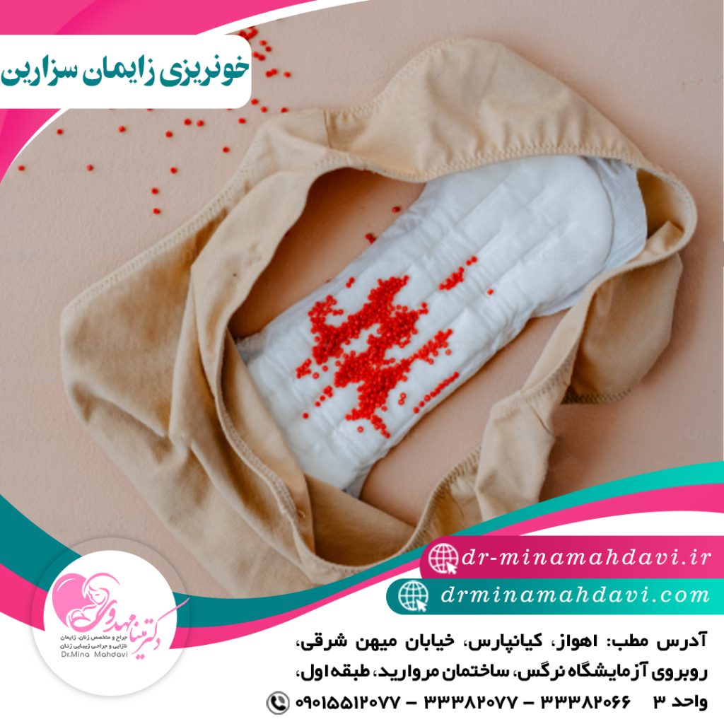 خونریزی بعد از زایمان سزارین